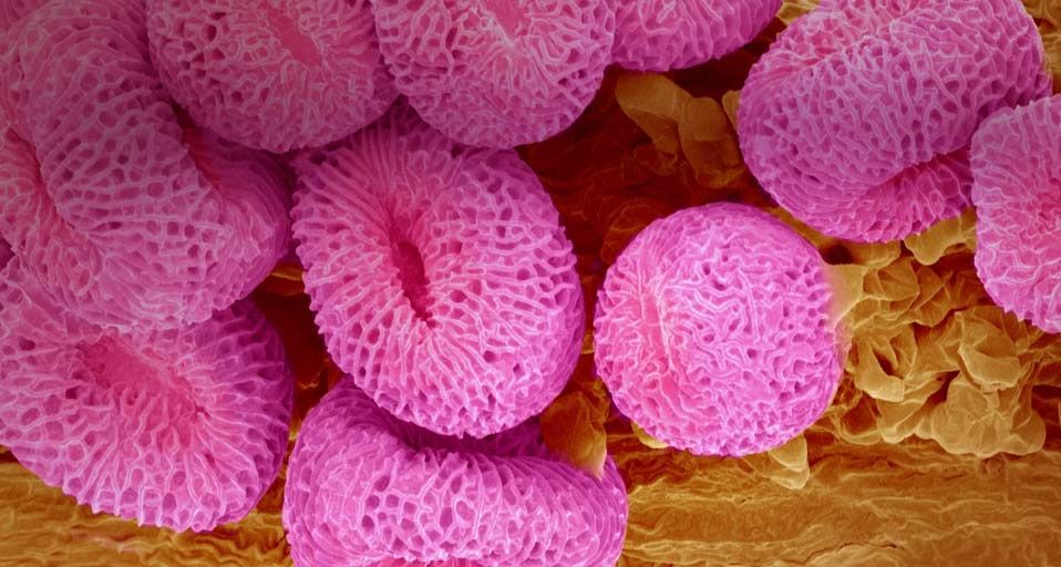 Geranium pollen at a magnification of x400