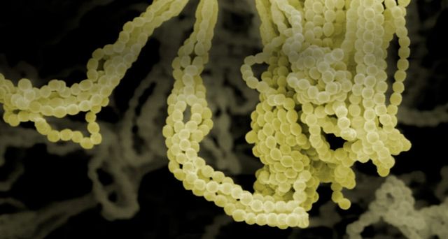 Aufnahme eines Rasterelektronenmikroskops von Penicillium chrysogenum, dem Pilz, der für die Produktion des Antibiotikums Penicillin benötigt wird – Visuals Unlimited/Corbis ©