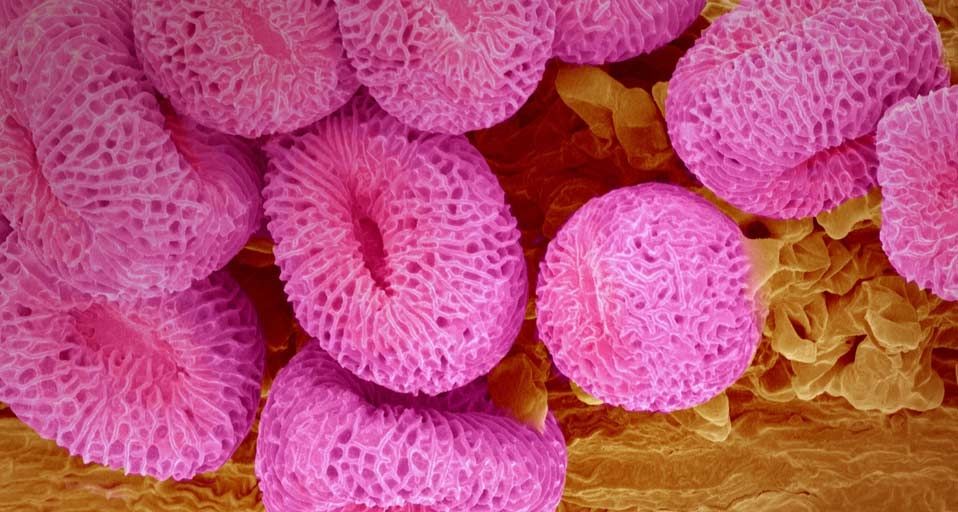 Geranium pollen at a magnification of x400