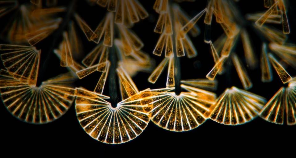 Licmophora flabellata, a type of sessile diatom, at a magnification of 100