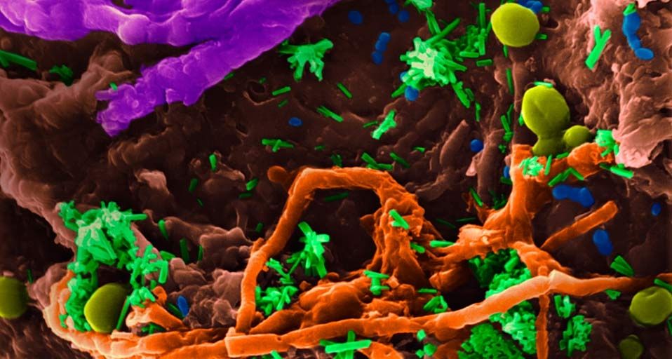 A variety of bacteria, yeast, and fungus on a kitchen sponge