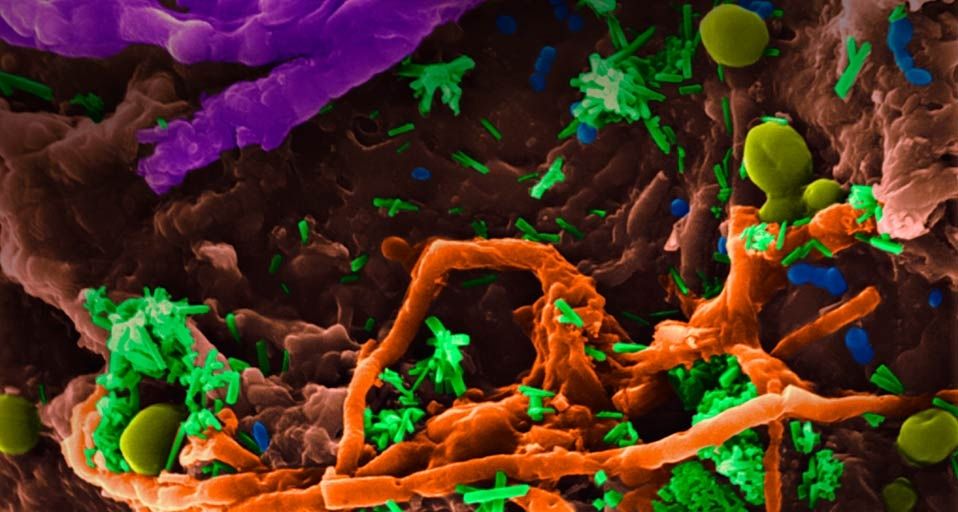 A variety of bacteria, yeast, and fungus on a kitchen sponge