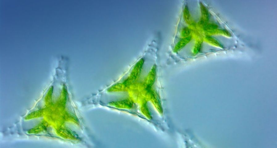 Light micrograph image of Green Algae Staurastrum