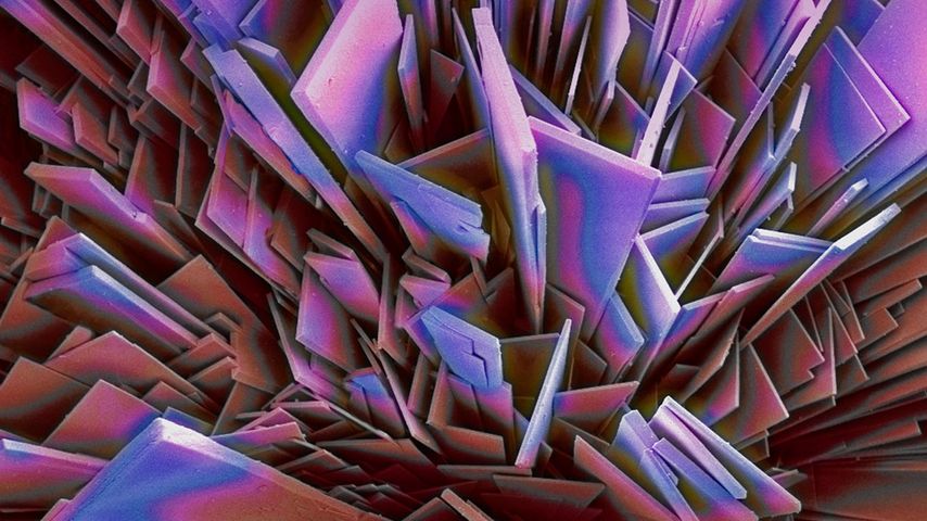 Phosphate crystals magnification