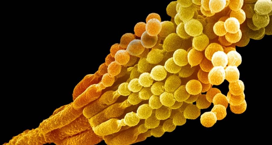 Penicillium notatum showing conidiophores and conidia - Dr Fred Hossler/Getty Images ©